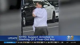 Suspect In Apparently Random Slashing Of 2-Year-Old In Custody