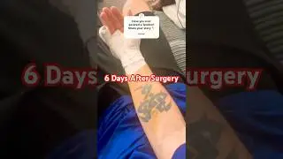 My Arm Turned Yellow? Injury Update & Pain Levels #InjuryUpdate #Bruising #HandInjury #YouTubeShorts
