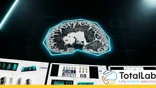 Phoretix Toolbox Phosphor Imaging Tutorial | Quantitative Analysis for Radiographic Images