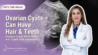 Understanding Ovarian Cysts: Types and Treatment Options