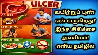 வயிற்றுப் புண் சிகிச்சை! ULCER &ndash;முழு தீர்வு. மருத்துவ சிகிச்சைTreatment Doctor Recommended Treatment