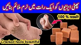 Cracked Heels Gone in 1 Night with Vaseline & Gur DIY Trick for Cracked Heels That Actually Works!