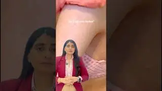Strawberry Skin | Keratosis Pilaris | Strawberry Skin treatment