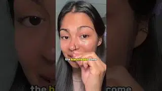 Remove Stubborn Blackheads in a Minute 😳