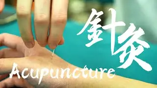 Does acupuncture really work? Come and discover the secret with me!