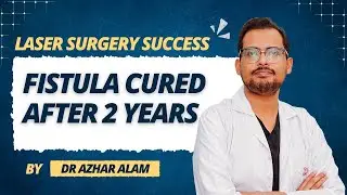Fistula Cured After 2 Years &mdash; Laser Surgery Success | Dr Azhar Alam