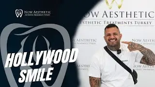 Hollywood Smile Now Aesthetic!