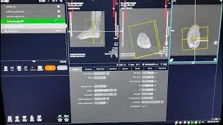 😮How to plan Mri Ankle||mri ankle planing