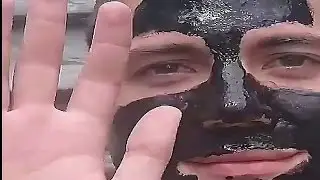 BLACK MASK acne killer success boy