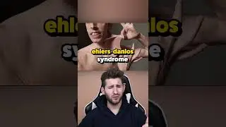 Эластичный человек