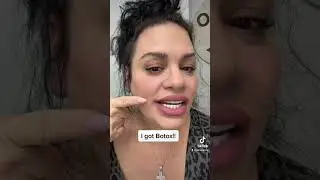 I got Botox and fillers.. don&rsquo;t judge