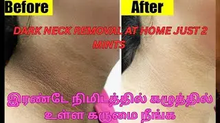 Neck Leaning Tips|Dirt and dark neck removal at home #homeremedies #skincaretips #darkneck #viral