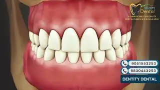 Anatomy of the Canines | Function, Structure & Importance | Dentity Dental