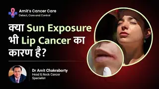क्या Sun exposure भी Lip Cancer का कारण है? | Can Sun exposure cause cancer | Dr Amit chakraborty