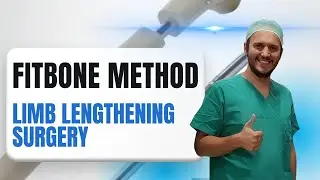 Fitbone Limb Lengthening Surgery Explained | How It Works, Safety & Realistic Results