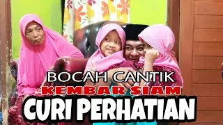 KONDISI TERKINI BOCAH KEMBAR SIAM DEWI DAN PUTRI.
