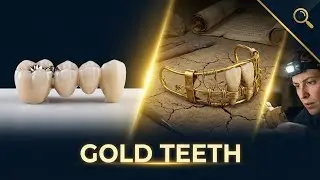 Ancient Dentists Used GOLD WIRE 2,500 Years Ago... Here's How They Actually Did It