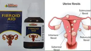 Fibroid Aid drops / Bakson's Fibroid Aid drops uses doses in hindi