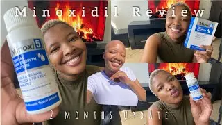 Minoxidil Review ||Side effects?? || How to use minoxidil || South African YouTuber  #roadto200subs