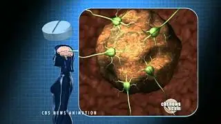 New Brain Cancer Treatment Promising