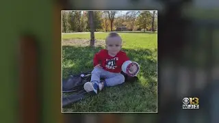 Orthopedic Experts In Baltimore Reconstruct Rare Deformity Of Infant From Overseas