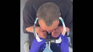 Facebow (part 2)