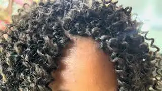 Acabamento frontal