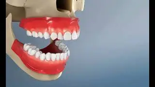 Redresser et aligner ses dents : Les goutti&egrave;res Orthodontiques ￼invisibles