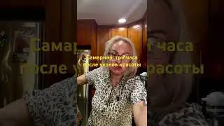 Самарина как я провела свой день: покупки в Костко и уколы красоты
