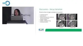 An Initial Clinical Experience with Surface Guided Radiation Therapy