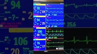 Central monitor, connect with all monitor #patientcare #patientsafety #patient_monitor #philips