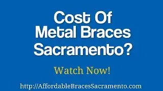Cost Of Metal Braces Sacramento