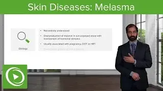 Skin Diseases: Melasma (Chloasma) &ndash; Pathology | Lecturio