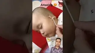 Enna Solla Song .Amazing Ear 👂 flex Magic Tricks #shorts #youtubeshorts #magic