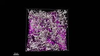 JID April 2023 Cover: Vimentin+ Cells and Extracellular Matrix in Human Dermis