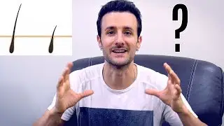 How Many Hair Transplants GRAFTS Do You Need for Thick Hair?