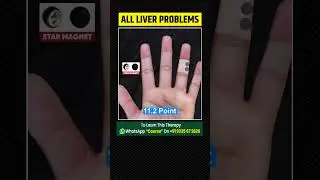 Acupressure Points For All Liver Diseases