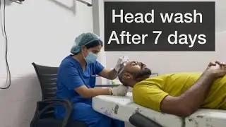 &ldquo;Day 7 Head Wash After Hair Transplant! First Cleaning Experience 💆&zwj;♂️✨&rdquo;