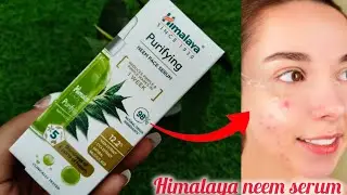 Himalaya purifying Neem face serum 5 part of neem Full review 2026