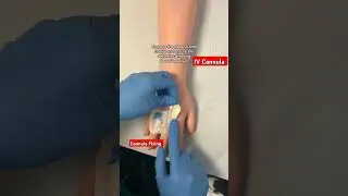 IV Cannula fitting kaise kare#ivcannulation #icu #ivinsertion 🩺👨&zwj;⚕️