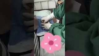 Stase Pelayanan Kontrasepsi || By. Heru Nugrah W.