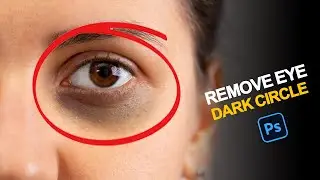 The Quick Remove Eye Dark Circle in Photoshop | Adobe Photoshop Tutorials  2025