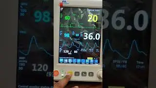 Allied Meditec M303 Vital Sign Monitor
