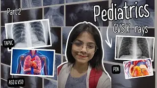 Peds CHDs Part 2: High-Yield X-ray Findings & Theory | Tricks That Help You NEVER Miss a Diagnosis