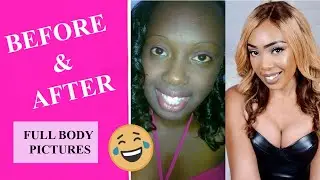 MY SKIN LIGHTENING BEFORE AND AFTER PICTURES