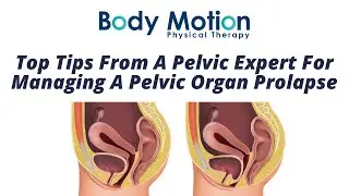 Top Tips From A Pelvic Expert For Managing A Pelvic Organ Prolapse