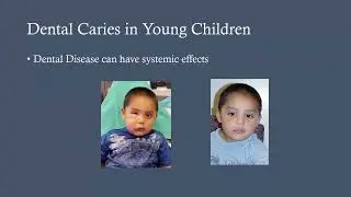 Region One Insights: Building Bright Smiles: Supporting Children's Oral Health in Your Community