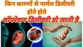kin conditions ke karn normal delivery hote hote operation delivery ho jati hai #normaldelivery