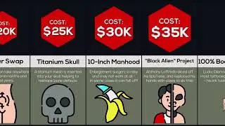 The Most Expensive Body Modifications