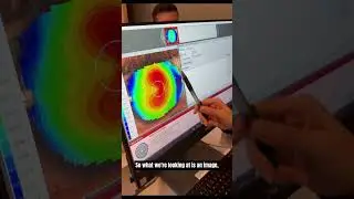 Understanding Corneal Topography